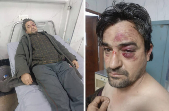 Gilgit-Baltistan Trader Brutally Attacked in Lahore’s Mustafa Town Market